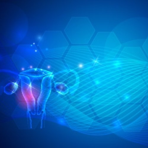 un possibile approccio terapeutico nel trattamento di selezionati casi di neoplasia ovarica un possibile approccio terapeutico nel trattamento di selezionati casi di neoplasia ovarica